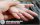 Bệnh chàm ở tay: Hình ảnh nguyên nhân dấu hiệu cách chữa trị