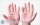 Vảy nến da tay : Nguyên nhân dấu hiệu và cách điều trị