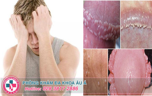 Mắc các bệnh viêm nhiễm có thể gây vô sinh ở nam giới