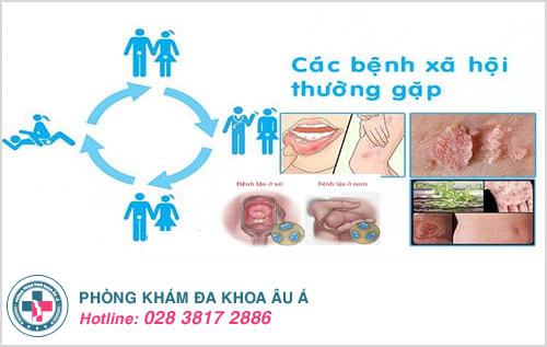 4 loại bệnh xã hội phổ biến bạn có thể mắc phải