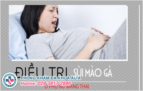 Hình ảnh minh họa điều trị bệnh sùi mào gà cho bà mẹ mang thai 