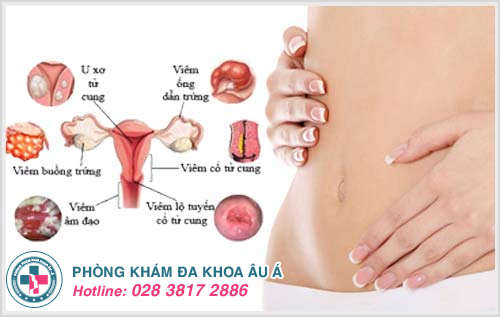 Viêm nhiễm phụ khoa lâu ngày gây ra nhiều bệnh nguy hiểm 