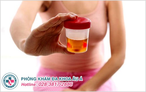 Bàng quang nằm ở đâu và dấu hiệu bạn cần phải đi khám bàng quang?