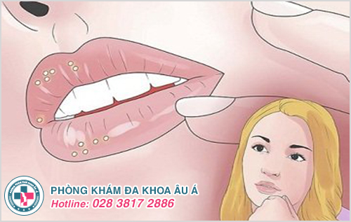 Bệnh lậu có lây qua đường nước bọt không?