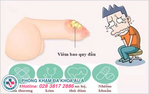 Bệnh viêm bao quy đầu có lây không