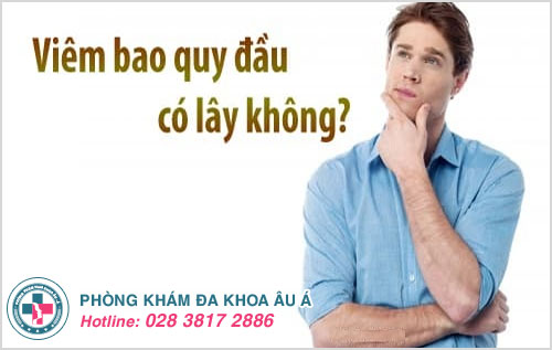 Bệnh viêm bao quy đầu có lây không