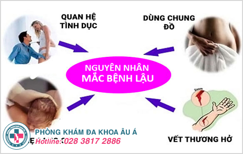 Những nguyên nhân gây ra bệnh lậu