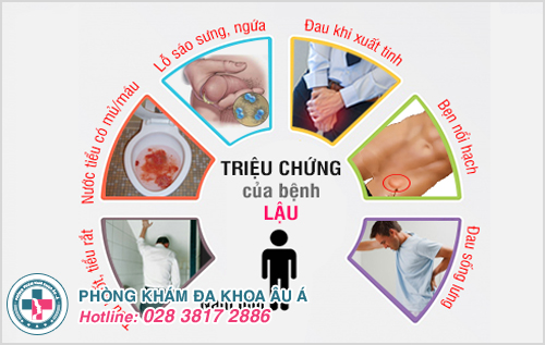 Biểu hiện bệnh lậu gây ra ở nam giới nhiều bệnh nghiêm trọng