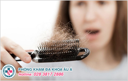 Bị rụng tóc nhiều ở phụ nữ là bệnh gì và Cách chữa trị
