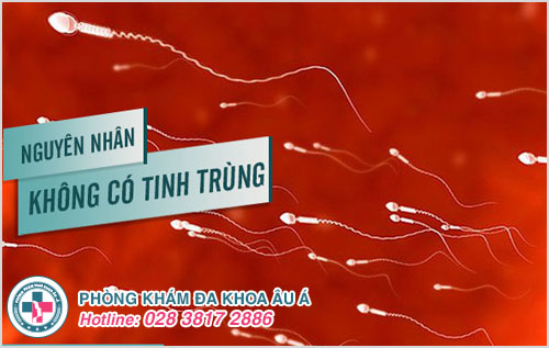 Cách chữa vô sinh ở nam giới do không có tinh trùng