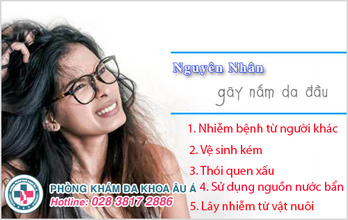 Cách trị nấm da đầu tận gốc nhanh chóng, hiệu quả