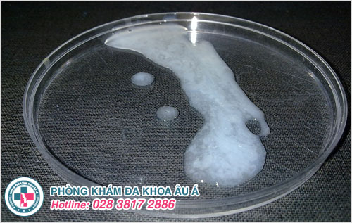 phân biệt tinh dịch khác tinh trùng
