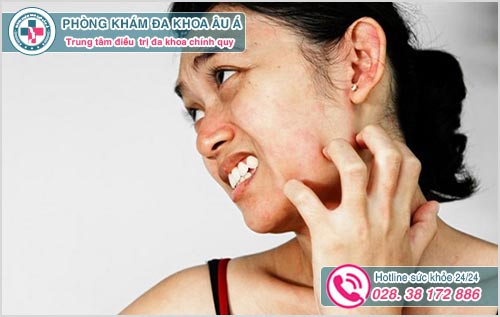 Da mặt bị nổi sần và ngứa là biểu hiện bệnh gì?