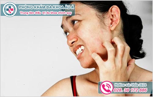 Da mặt khô bị ngứa nổi mẩn đỏ là dấu hiệu bệnh gì?
