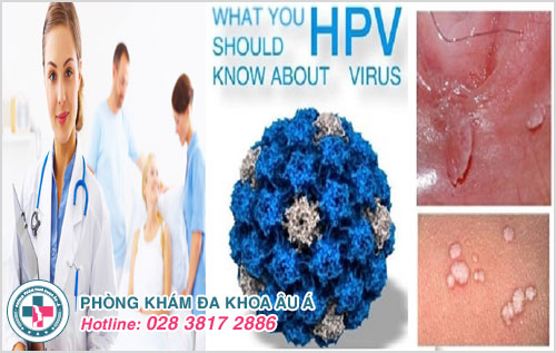 Dấu hiệu nhiễm virus HPV và cách điều trị an toàn hiệu quả