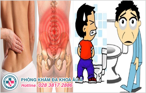 Đi tiểu buốt và đau lưng là dấu hiệu bệnh gì?