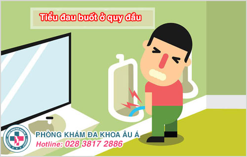 Đi tiểu đau buốt quy đầu có sao không?