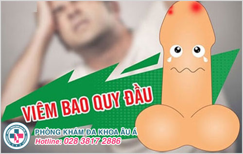 địa chỉ chữa viêm bao quy đầu hiệu quả tại tphcm