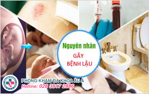 Những nguyên nhân gây bệnh lậu