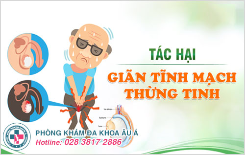 Điều trị giãn tĩnh mạch thừng tinh bằng những phương pháp nào hiệu quả?