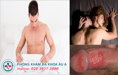 Dương vật bị nổi mẩn đỏ sau khi quan hệ có nguy hiểm không?