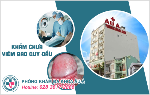 hình ảnh viêm bao quy đầu