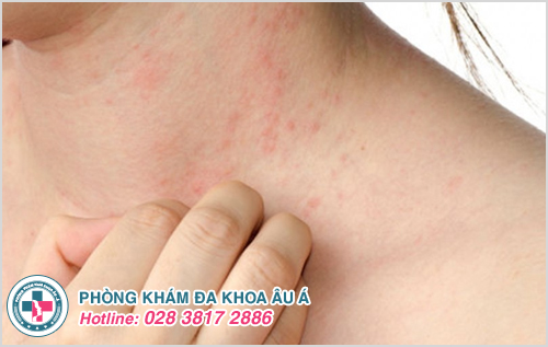 Phòng khám Da liễu Quận 5