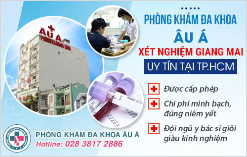 Xét nghiệm giang mai bao nhiêu tiền