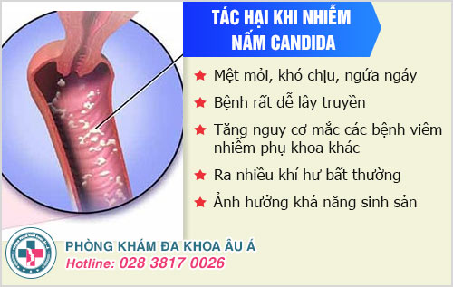 Bị nấm Candida uống thuốc gì