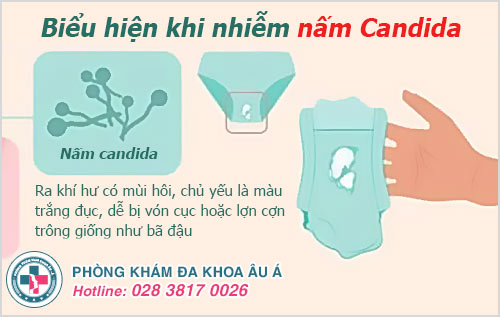 Bị nhiễm nấm Candida phải làm sao