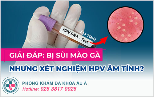 Tại sao bị sùi mào gà nhưng xét nghiệm HPV âm tính?