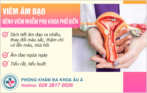 Các dạng viêm âm đạo thường gặp