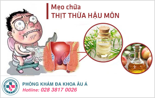 cách chữa thịt thừa hậu môn