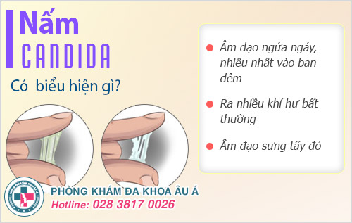 cách điều trị nấm Candida tại nhà