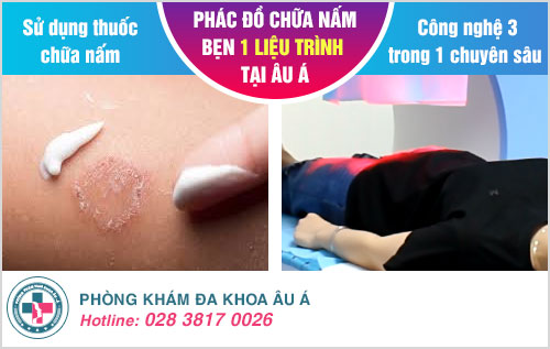 cách trị nấm bẹn tại nhà