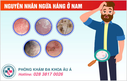 cách trị ngứa háng ở nam giới tại nhà