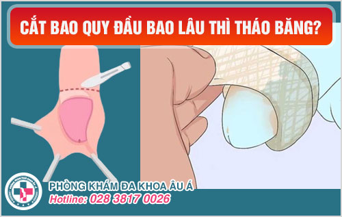 Cắt bao quy đầu bao lâu thì tháo băng?