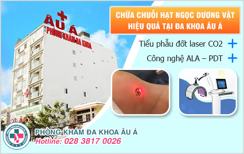 Chuỗi hạt ngọc dương vật có hại không