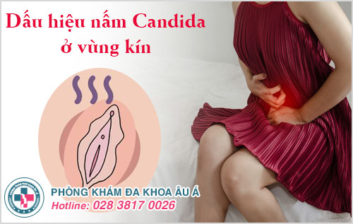 dấu hiệu nấm Candida ở vùng kín