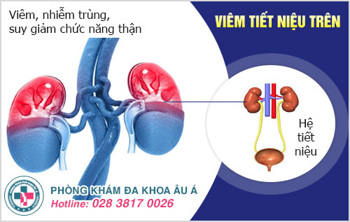 Hình ảnh viêm đường tiết niệu