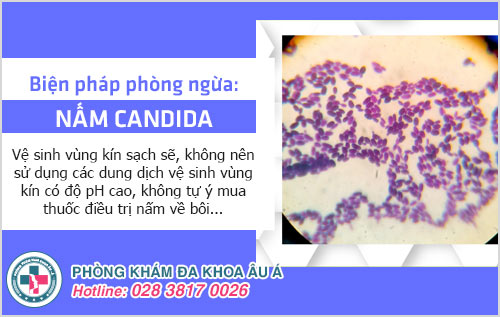 Nấm Candida bị tiêu diệt ở nhiệt độ bao nhiêu