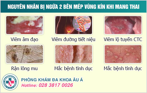 Ngứa 2 bên mép vùng kín khi mang thai