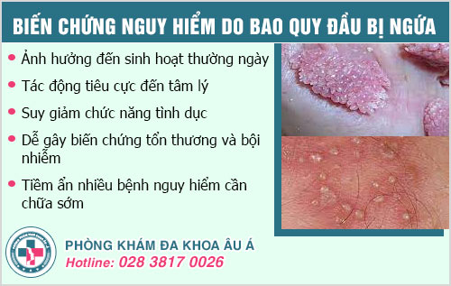 ngứa bao quy đầu sau quan hệ tình dục