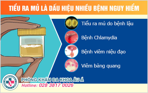 nước tiểu có mủ