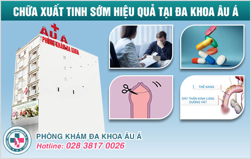 Quan hệ dưới 5 phút đã ra có phải bị xuất tinh sớm