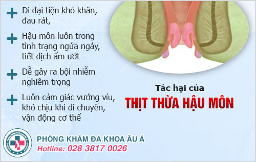 Thịt thừa hậu môn phải làm sao