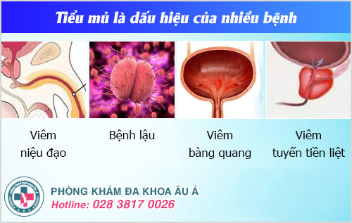 tiểu mủ