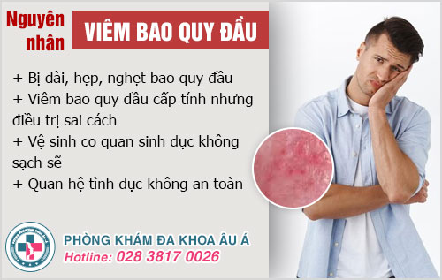 Viêm bao quy đầu cấp và mãn tính