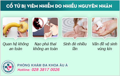 Viêm cổ tử cung