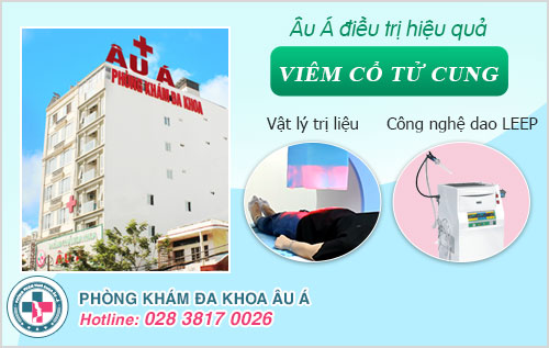 Viêm cổ tử cung